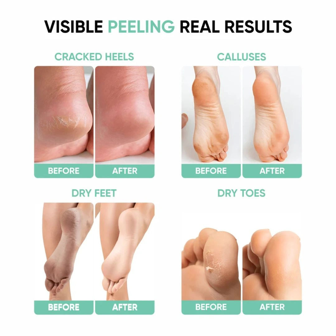 Exfoliating Foot Peel Mask