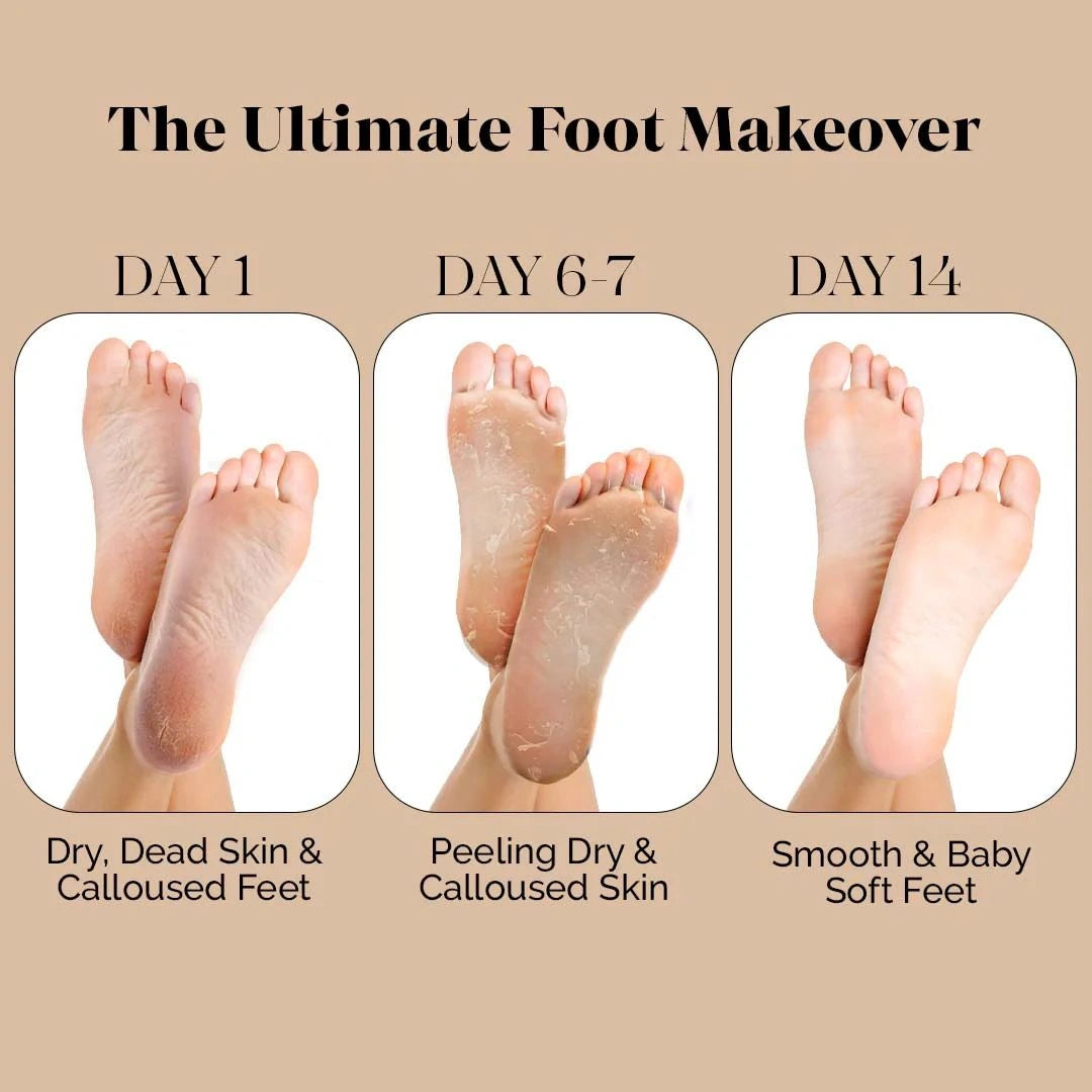 Exfoliating Foot Peel Mask
