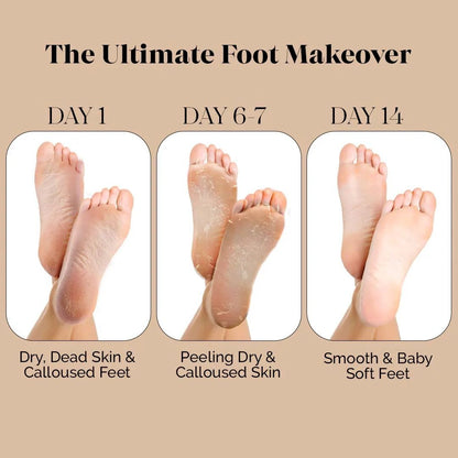 Exfoliating Foot Peel Mask