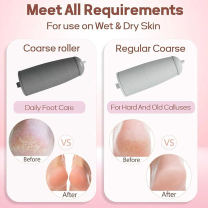 Electric Foot Callus Remover |Rechargeable Pedicure Tool