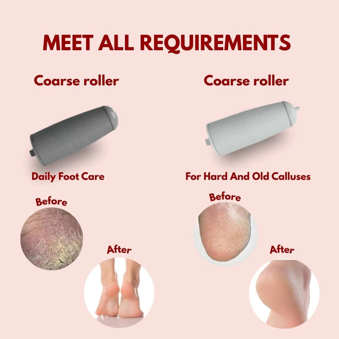 Electric Foot Callus Remover |Rechargeable Pedicure Tool