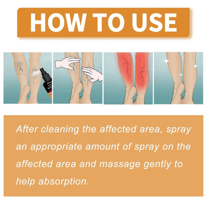 Varicose Veins Treatment Spray(Buy 1 Get 2 Free)