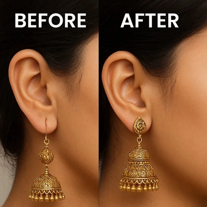 Premium Earlobe Support Patches (100 PCS)