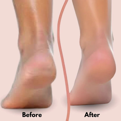 Electric Foot Callus Remover |Rechargeable Pedicure Tool