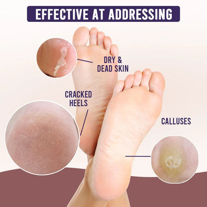 Exfoliating Foot Peel Mask