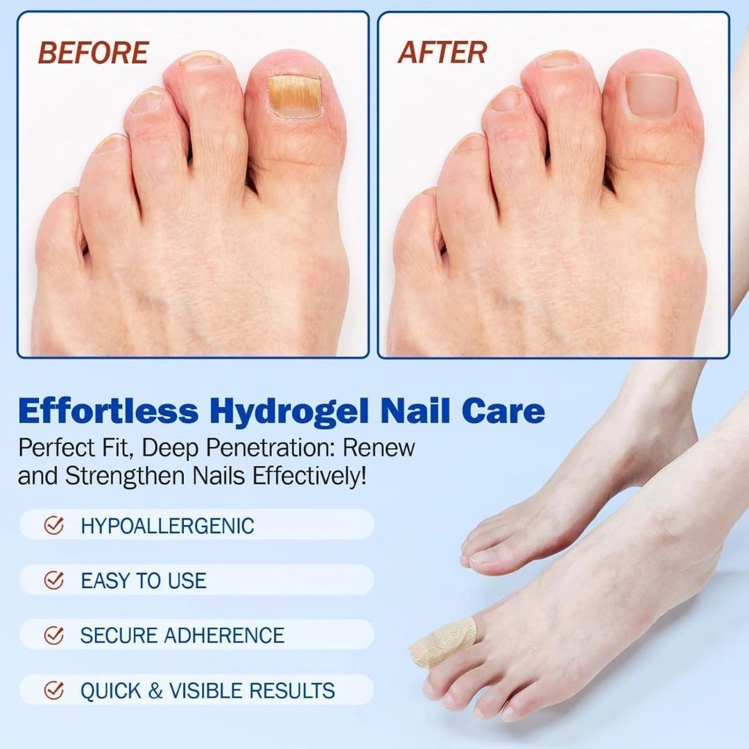Advanced Fungal Nail Patch Treatment