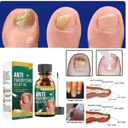 Anti Paronychia Relief Oil