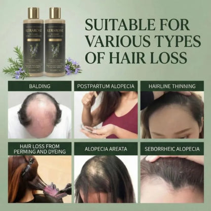 Rosemary Growth Support Shampoo