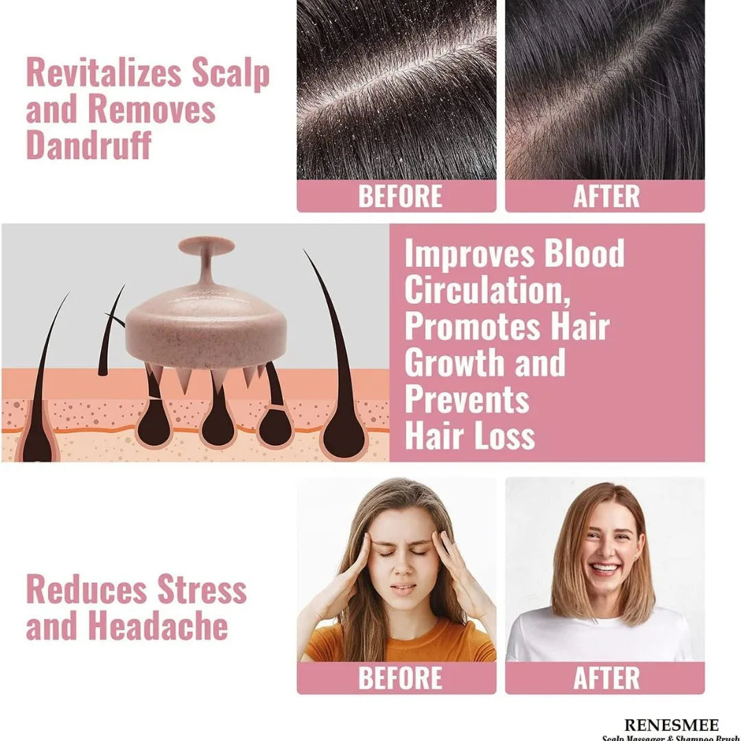 Soft Silicone Scalp Massage Brush