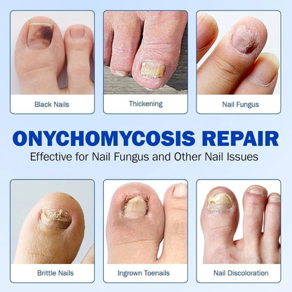 Advanced Fungal Nail Patch Treatment