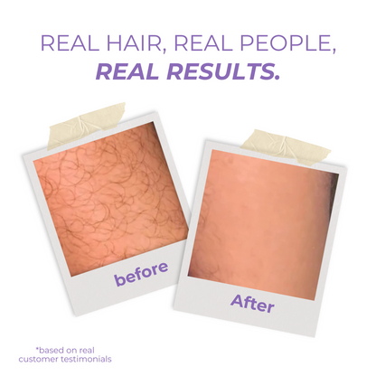 Crystal Hair Remover For Smooth Skin