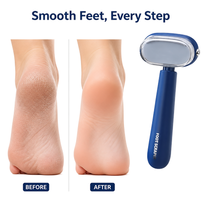 Effortless Foot Scraper