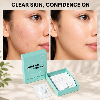 LED Therapy Acne Patch (Pack of 5)