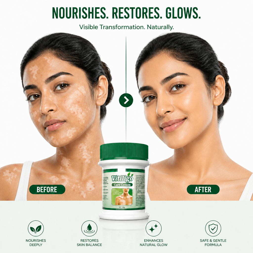 Vitiligo Care Cream