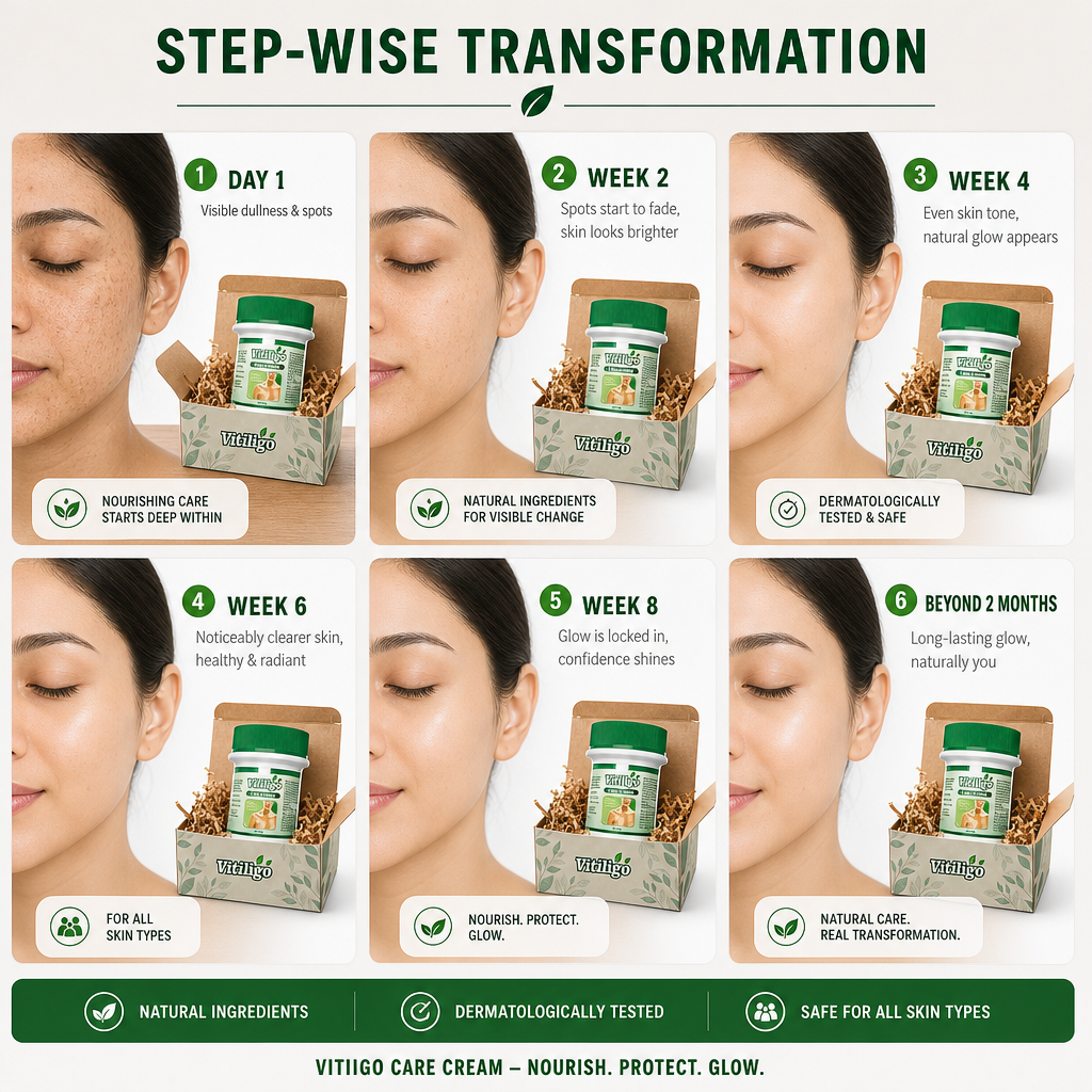 Vitiligo Care Cream