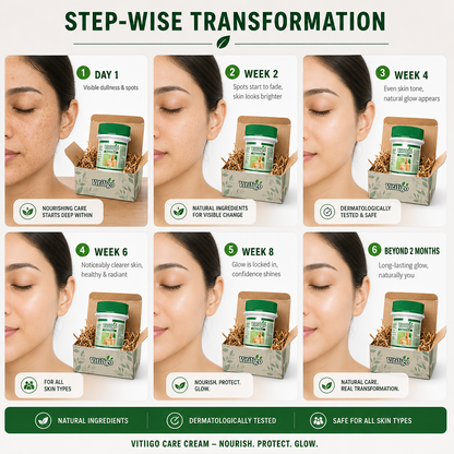 Vitiligo Care Cream